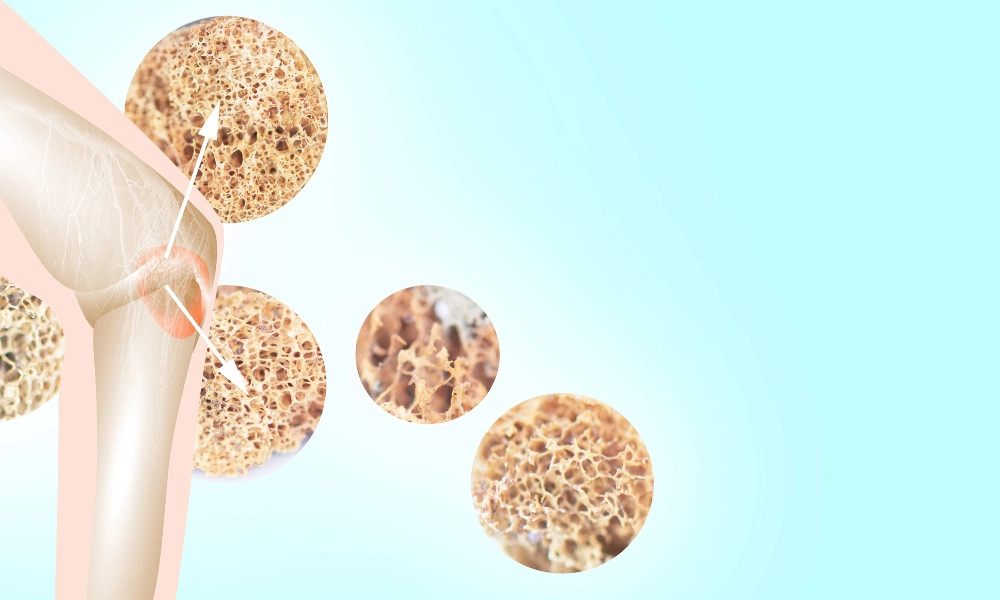 alt text: Hình ảnh người tập yoga, đại diện cho sức khỏe xương khớp