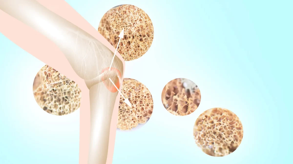 Các triệu chứng dễ thấy nhất là ở các cơ tay, chân