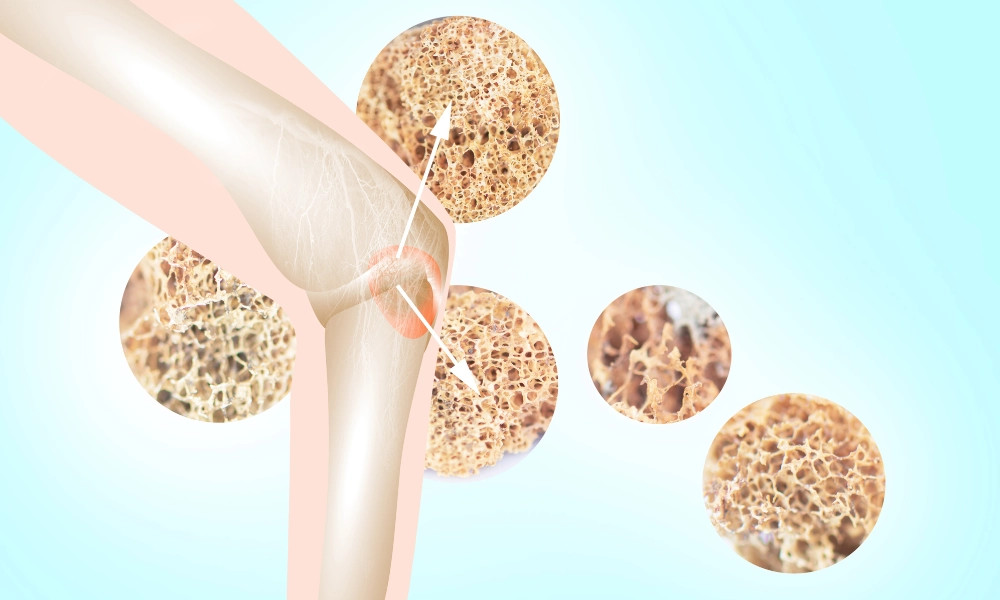 Duy trì giúp xương khoẻ mạnh